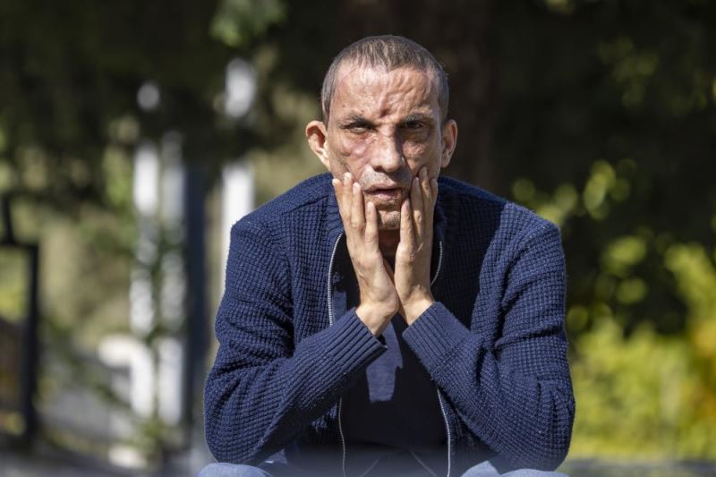 Nakille yüzleri gibi hayatları da değişti