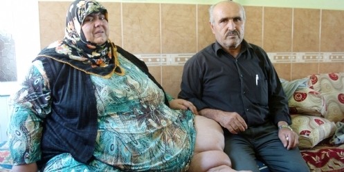 Obezite hastası kadının umuda yolculuğu 