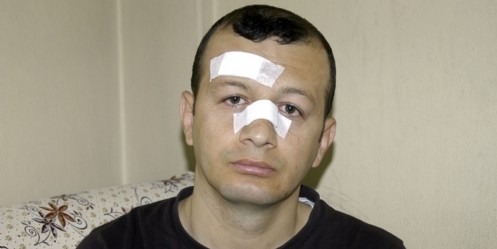 Şoföre Darp