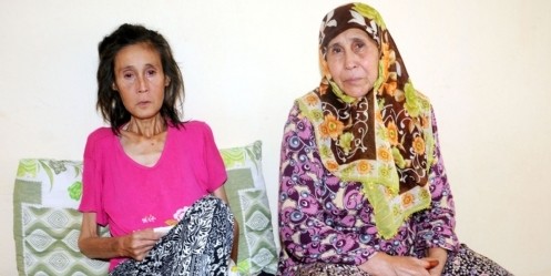 Hastalığı teşhis edilemeyen kadın 25 kiloya düştü