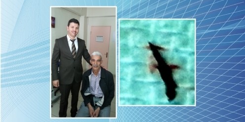 Gözünden 7 milimetrelik tel çıkarıldı
